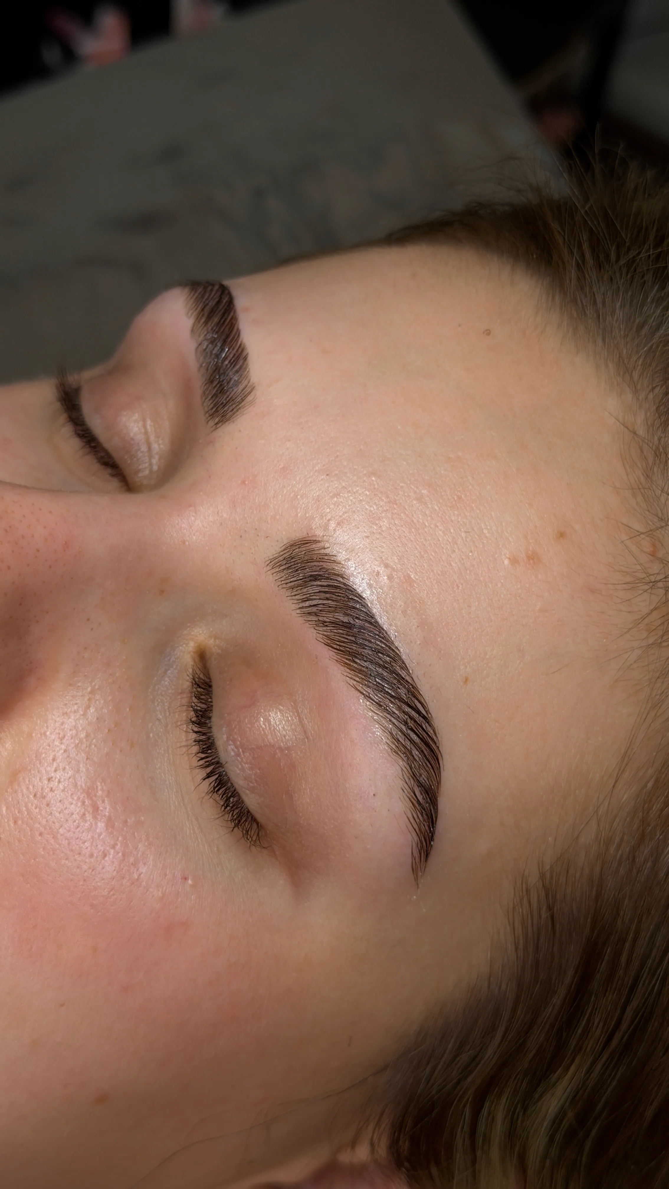 Voll wirkende, nach oben gelegte Braue nach dem Brow Lift